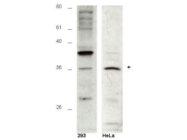 Anti-Hus1B Antibody - Western Blot