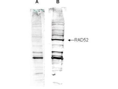Anti-Human RAD52 Antibody - Western Blot