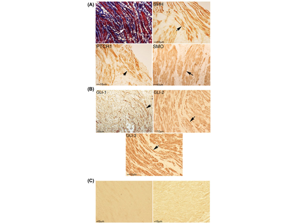 Immunohistochemistry using Gli3
