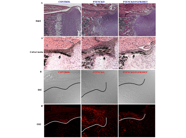 Immunohistochemistry using Gli2