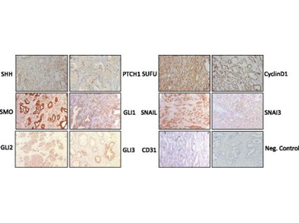 Immunohistochemistry using Gli2