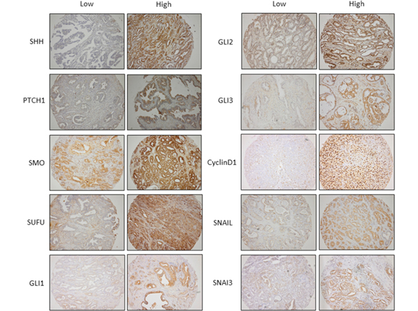 Immunohistochemistry using Gli2