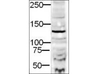 Anti-DIA-2 Antibody - Western Blot