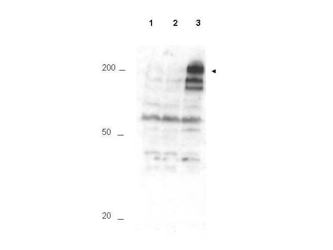 Anti-APC1 pS355 Antibody - Western Blot