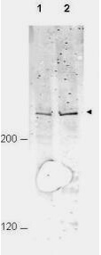 Anti-APC1 pS377 Antibody - Western Blot