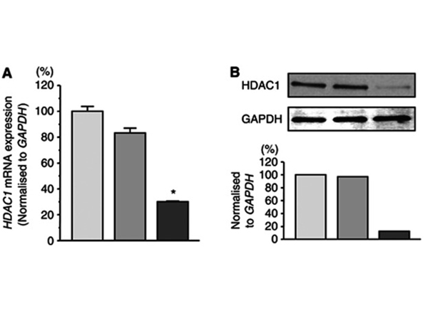 Western Blot using HDAC1