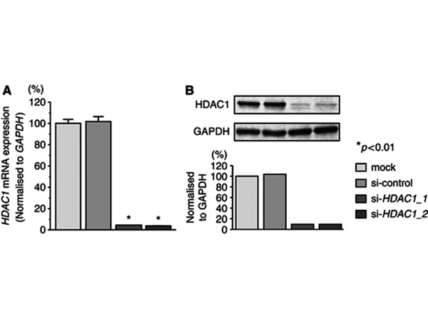 Western Blot using HDAC1