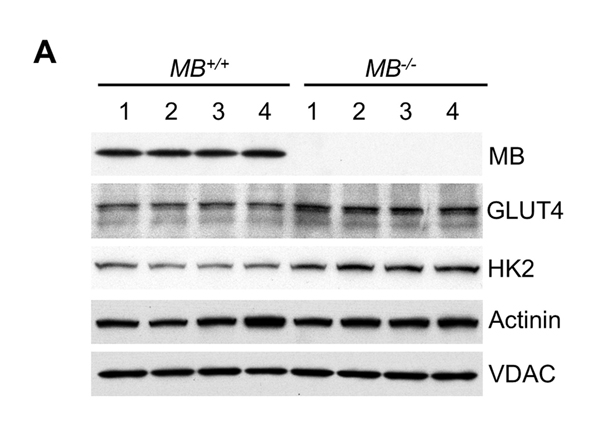 Western Blot using VDAC