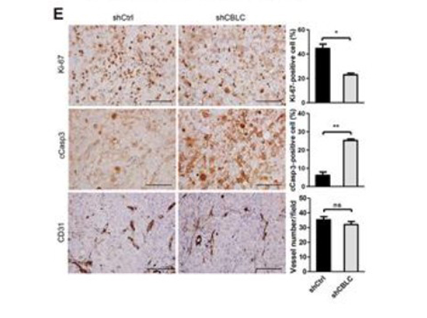 Immunohistochemistry using cbl-c