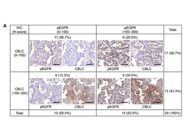 Immunohistochemistry using cbl-c