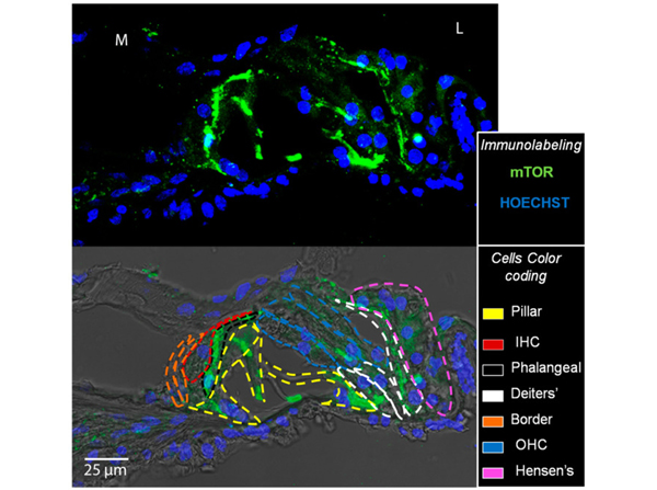 Immunofluorescence using mTOR
