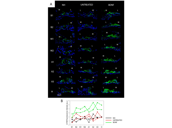 Immunofluorescence using mTOR