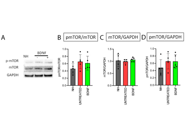 Western Blot using mTOR
