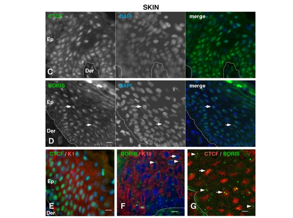 Double Immunofluorescence using Boris