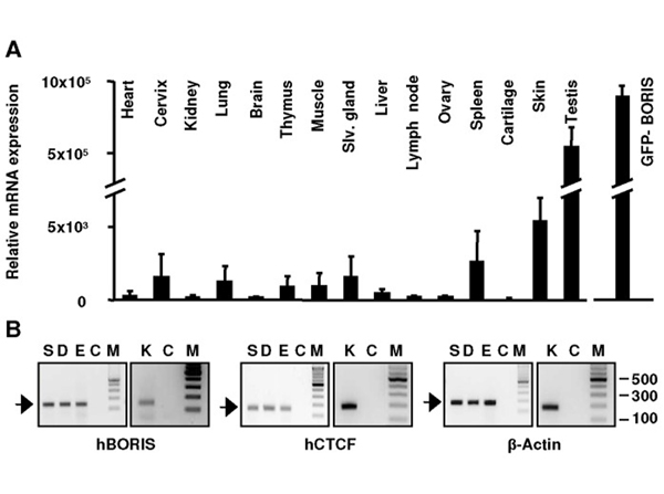 Western Blot using Boris