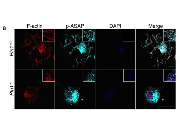 Immunofluorescence using ASAP1 pY782