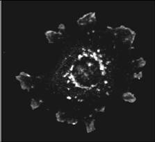 Anti-ASAP1 Antibody - Immunofluorescent Microscopy