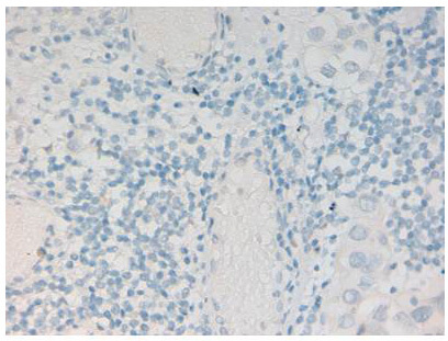 Anti-Histone H2AvD pS137 Antibody - Immunohistochemistry
