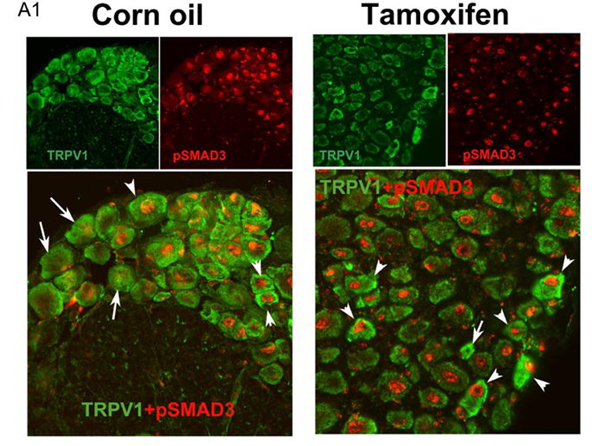 Immunofluorescence using Smad3 pS426pS425