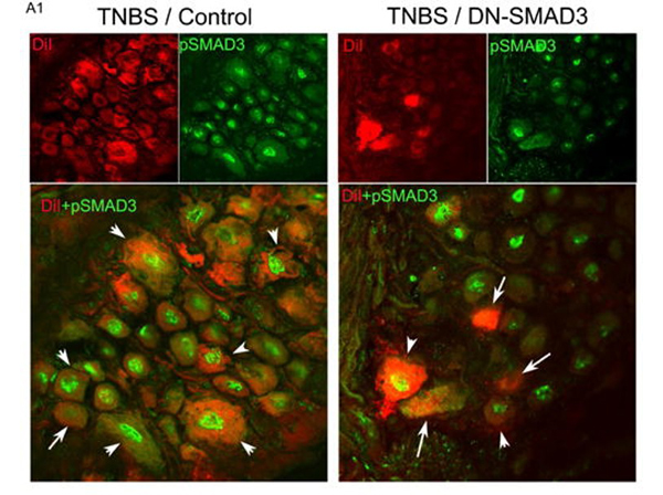 Immunofluorescence using Smad3 pS426pS425