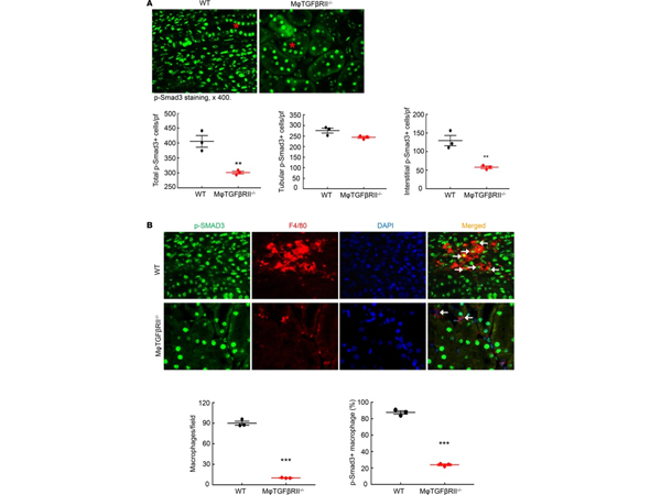Immunofluorescence using Smad3 pS426pS425