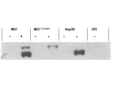 Anti-Smad3 pS423 pS425 Antibody - Western Blot