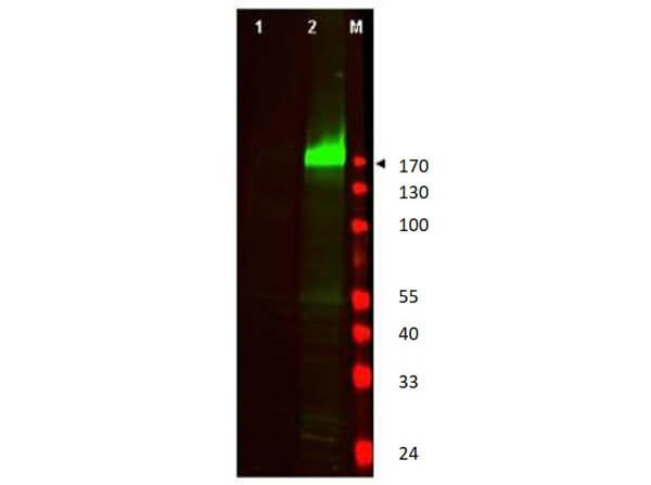Western Blot of EGFR phospho Y1197 Antibody