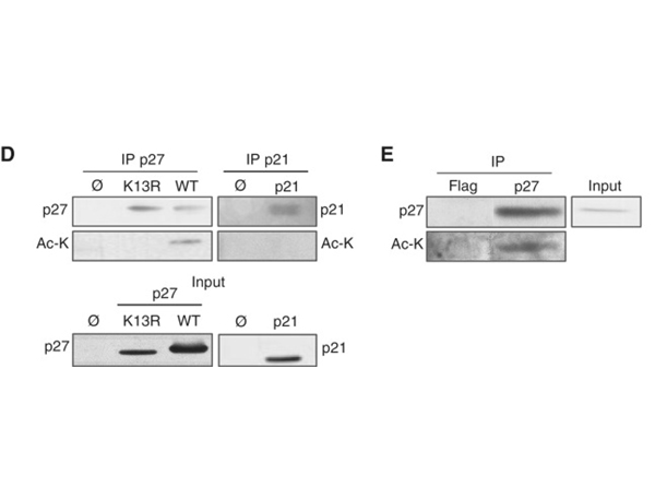 Immunoprecipitation using Lysine