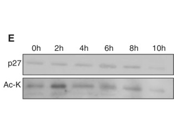 Immunoprecipitation using Lysine
