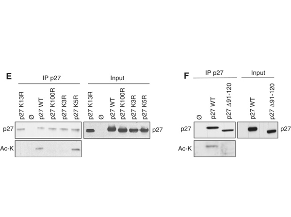 Western Blot using Lysine