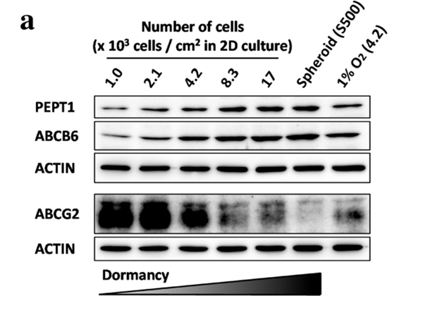 Western Blot using ABCB6