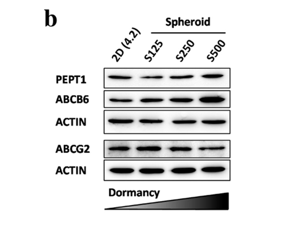 Western Blot using ABCB6