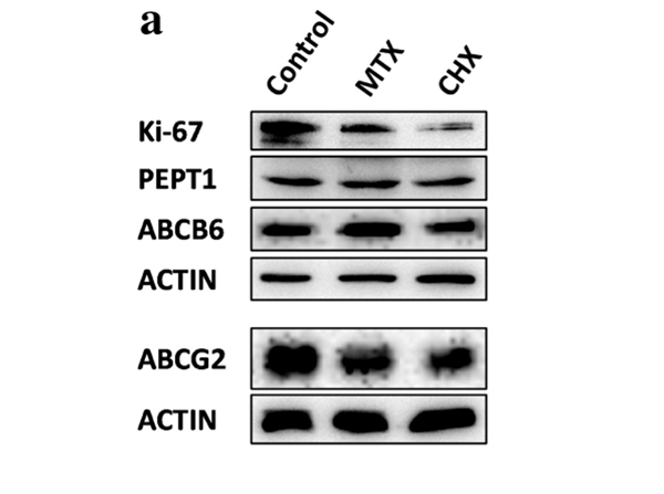 Western Blot using ABCB6