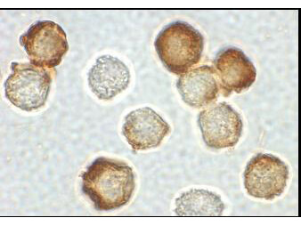 Anti-IRAK-2 Antibody - Immunohistochemistry