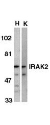 Anti-IRAK-2  Antibody - Western Blot