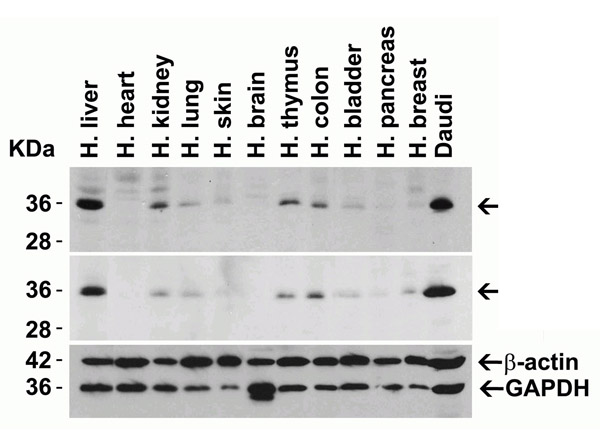 Western Blot Validation of MyD88.