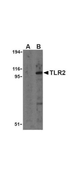 Anti-TLR2 Antibody - Western Blot