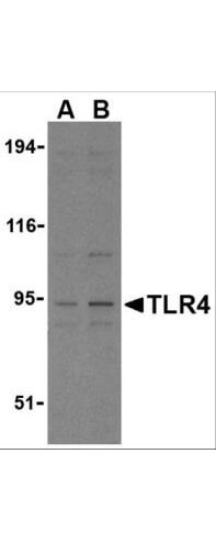 Anti-TLR4 Antibody - Western Blot