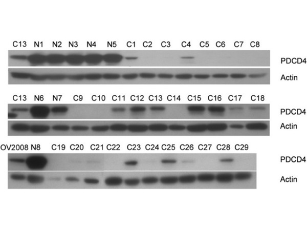 Western Blot using PDCD4