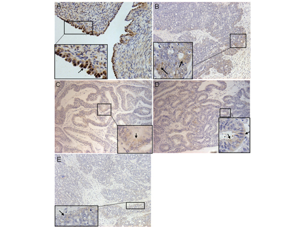 Immunohistochemistry using PDCD4