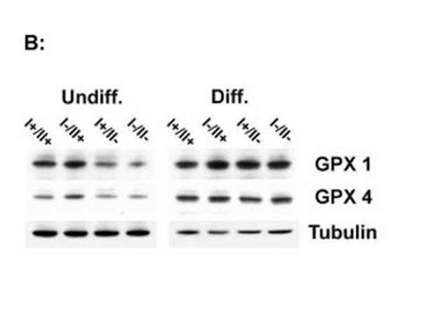 Western Blot using GPX4