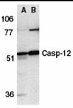 Anti-Caspase-12 Antibody - Western Blot