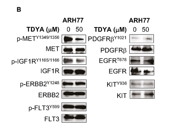 Western Blot using cMET pY1349pY1356