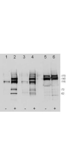 Anti-c-Met pY1349pY1356 Antibody - Western Blot