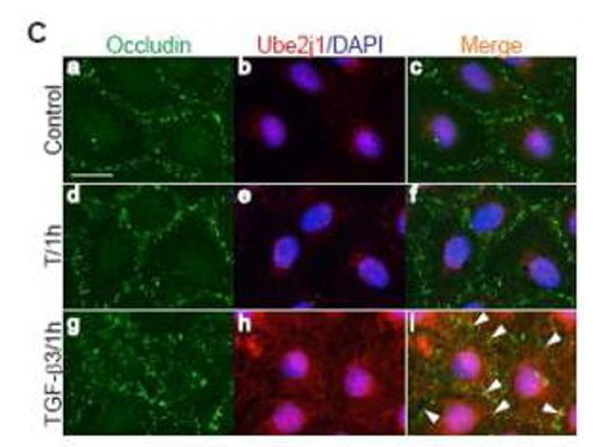 Immunofluorescence using UBE2J1