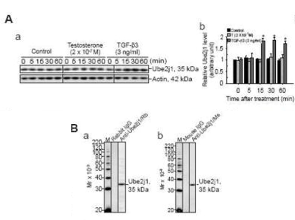 Western Blot using UBE2J1