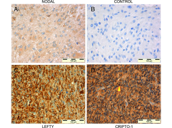 Immunohistochemistry using Cripto1