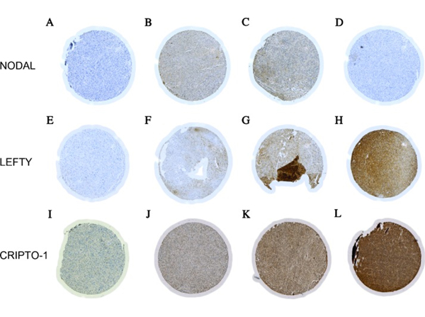 Immunohistochemistry using Cripto1