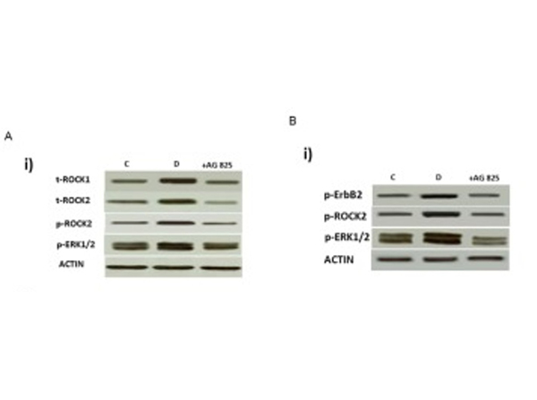 Western Blot using ROCK2 pY256
