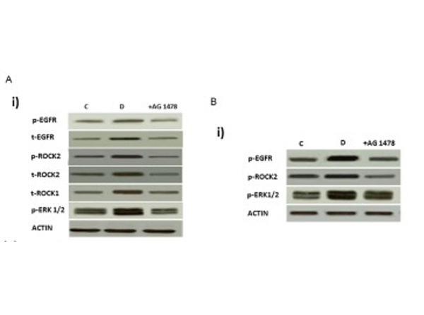 Western Blot using ROCK2 pY256